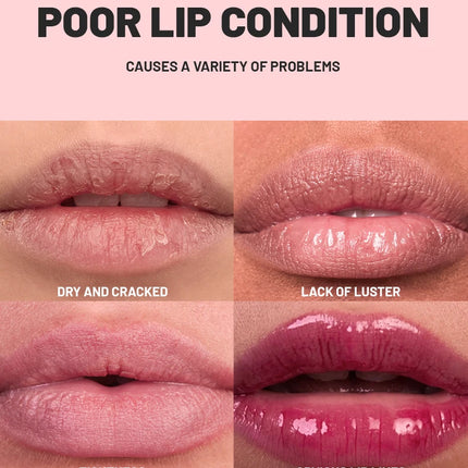Christmas marble colored lip balm, moisturizing lips, moisturizing dry lips, a great choice for holiday gifts.