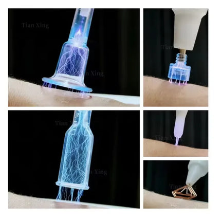 Cold Plasma with Argon Gas Professional Fractional Cold Plasma Sterilization equipment Cold Plasma Machine for Wound Therapy