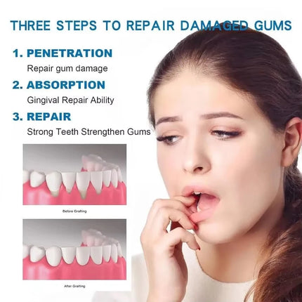Quick Gum Repair Gel Effectively Relieve Tooth Allergy Cavities Tooth Cleaning Toothpaste Relieve Tooth Damage Serum