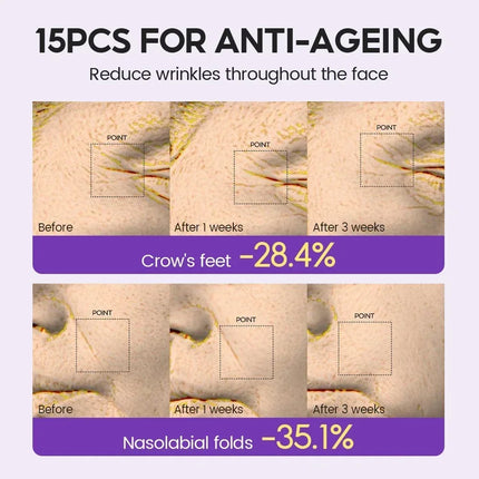 15 bottles of retinol+xylose precursor ampoule essence