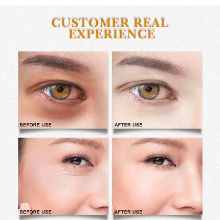 ARTISCARE Gold Osmanthus Eye Mask for Dark Circles Hyaluronic Acid Moisturizing Eye Patches Eye Care