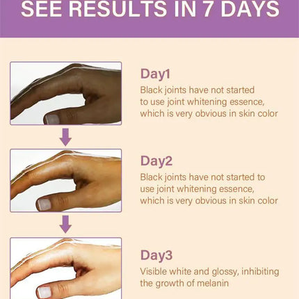 Fast Whitening Dark Knuckles Brighten Hand Cream Melanin Corrector Moisturizing Intense Stains Remover Products Korean Skin Care
