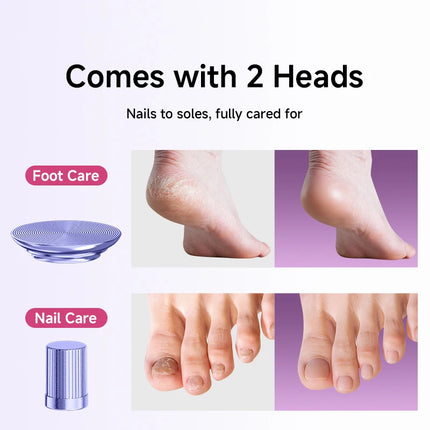 2-in-1 Electric Foot Grinder & Nail Grinder with 60 Sanding Discs Anti-Slip Striped Grip Aluminum Alloy Electric Callus Remover