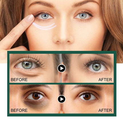 Cordyceps Eye Cream 30g Reduce Wrinkles Appearance Hydrating Brightening Under Eye Treatment Dark Circle Care Firming Eye Cream