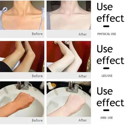Body Whitening Cream Private Parts Underarm Knee Thigh Inner Melanin Bleaching Brighten Lotion Dark Skin Healthy White Body Care