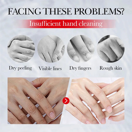 SADOER Kojic Acid Hand Cream Moisturizing Nourishing Brightening Hydrating Hand Creams Beauty Hands Skin Care Products