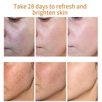 Effective Whitening Freckles Cream Remove Melasma Dark Spots Fade Melanin Pigmentation Moisturizing Brighten Skin Care Products