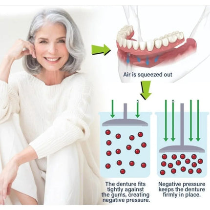 Immediate Dentures: Denture bases designed specifically for edentulous adults