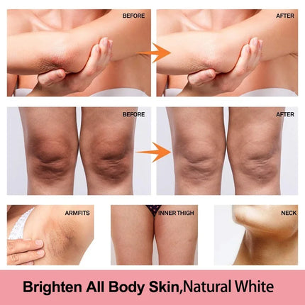 Niacinamide Body Whitening Cream For Underarm Bleaching Armpit Lightening Intimate Area  Moisturizer Korean Skin Care Product
