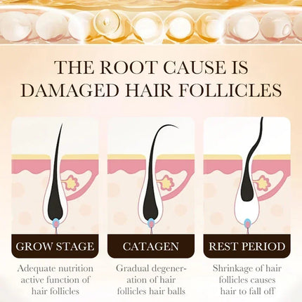 20ml Anti Hair Loss Effective Grow Thicker Hair Biotin Fast Hair Growth Oil Products Care Scalp Massage Treatments  For Men