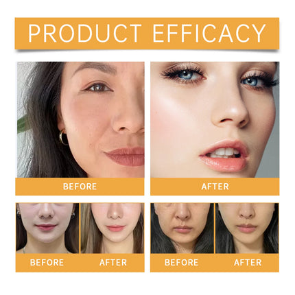 Nasolabial Folds Patch Contain Collagen Hyaluronic Acid Firming Skin Fade Fine Lines Deep Moisturizing Facial Mask Anti WrinkleA