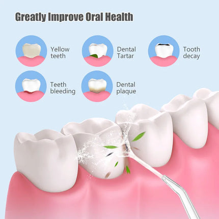 Water Dental Waterpick Irrigator Ipx7 Waterproof Irrigation Mouthwash Machine Oral Floss Flosser Irigator For Teeth Cleaner