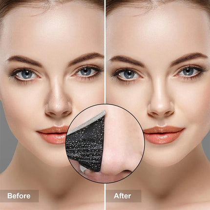 Blackhead Remove Mask Peel Nasal Strips Deep Shrink Cleansing Pore Nose Black Head Remove Stickers Unisex Skin Care Mask Patch