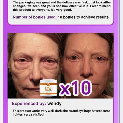 Eye massage instrument, relieve eye fatigue, eliminate eye bags, reduce dark circles, brighten eyes