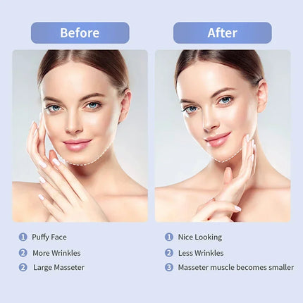 V Face Lift Massage Device Face Contour EMS Massage Double Chin Remove Red Blue Light Heat V-shaped Face Lift Beauty Instrument