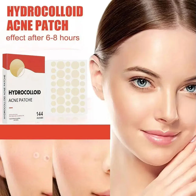 144pcs Invisible Removal Pimple Anti-Acne Hydrocolloid Patches Spots Marks Concealer Repair Sticker Waterproof Beauty-health