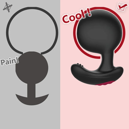 Anal Vibrator Inflatable Butt Plug Remote Prostate Massager Automatic Inflation Vibrating Male Female Prostate Stimulator