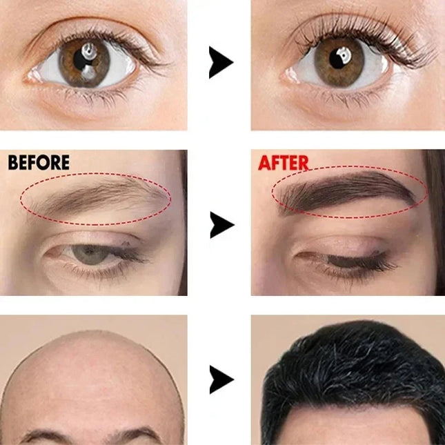 Eyebrow Fast Growth Serum Natural Eyelash Becomes Thicker Fuller Lengthening Prevent Baldness Eye Care Product Anti Hair Loss