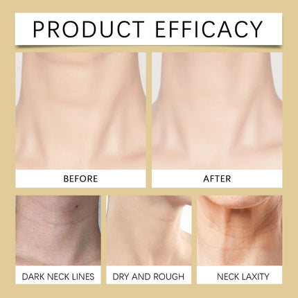 HOYGI Ah-8 Neck Cream Hexapeptide Firming Skin Tightening Sagging Reduce Fine Lines Smoothing Hyaluronic Acid Massage Lotion
