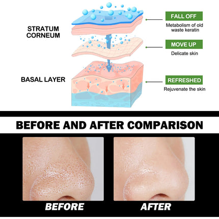 Nose Blackhead Remover Cream Peel Nasal Strips Deep Cleansing Shrink Pore Nose Black Dots Remove Stickers Skin Care Makeup