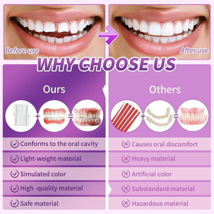 Comfort Silicone Dentures, Unisex Upper/Lower Teeth, DIY Temporary Fix for Confident Smile in Minutes