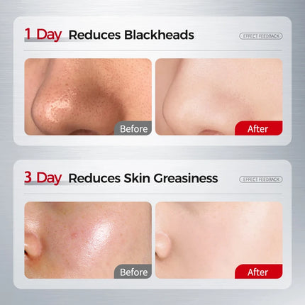 Amino Acid Korean Facial Cleanser with Salicylic Acid – Deep Cleansing, Oil Balance, Help with Pore Tighten, Acne & Blackheads