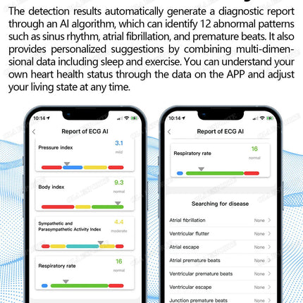 New ECG Smart Ring Heart Rate Blood Pressure Oxygen Body Temperature Sleep Monitoring Rings Waterproof Fitness Sports smartring