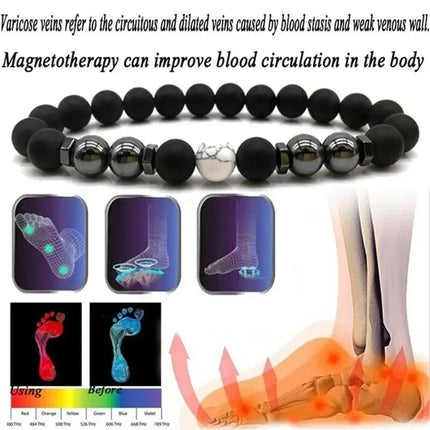 Anti-Swelling Black Obsidian Anklet Bracelet Treatment  Adjustable Weight Loss Magnetic Therapy Magnet Anklet Bracelet Women Men