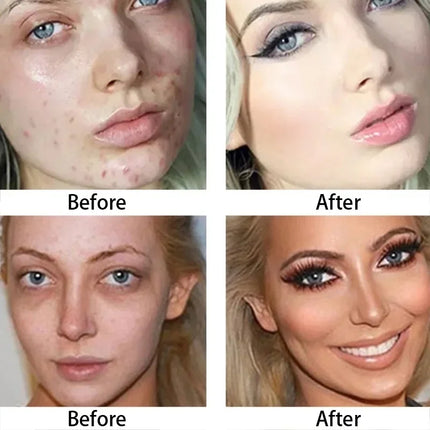 14 Colors Concealer Cream Stick Long Lasting Waterproof Concealer Foundation Soft Spotted Acne Mark Makeup Cover Cosmetics