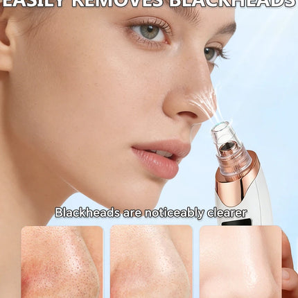 Blackhead Remover pimples and blackheads vacuum pores removal  facial skin cleansing device For Deep cleaning home