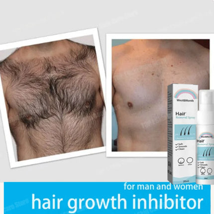 Hair removal spray powerful hair part healthy painless hair removal growth inhibitor male and female body care Korean products