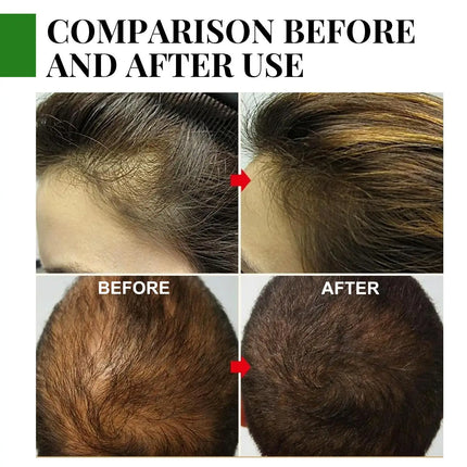 Natural Ginger Hair Care Essential Oil