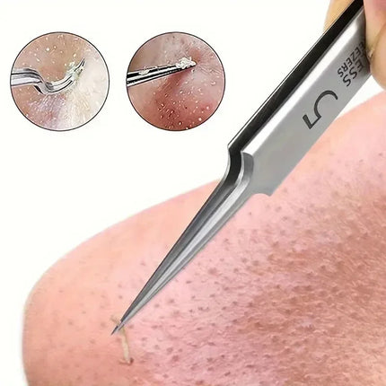 New 1/3 Pack Extra Fine No. 5 Cellular Acne Blackhead Tweezers - Facial Beauty Remove Acne Needle Tools for Skin Care Tools