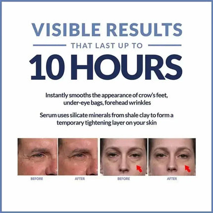 Instant Eye Cream For Anti Aging Dark Circles Bags Puffiness Great Under Eye Skin Face Tightening Eye Lift Treatment Care A