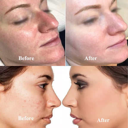 8ml Stayve BB Cream Glow Facial Serum Ampoule Essence Foundation Beginner Starter Kit Niacinamide/Peptide Face Skin Care