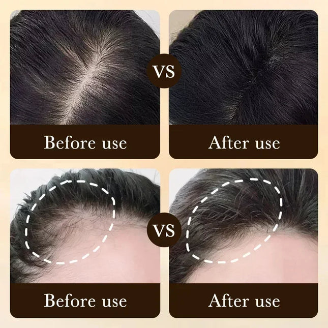 Biotin fast Hair Growth oil Products Care Scalp Massage Treatments Anti Hair Loss Effective Grow Thicker Hair serum for men