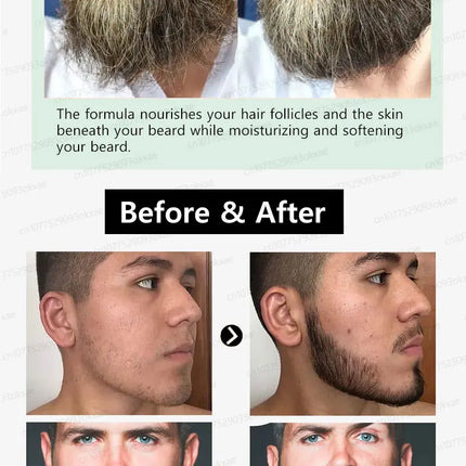 Beard growth essence. It helps your beard grow quickly, and is a must-have for mature men. It makes you look more manly and is e