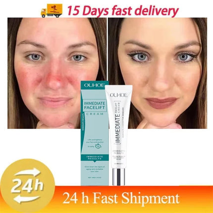 Facial Redness Repair Cream Improve Sensitive Skin Dryness Moisturizer Hydrating Sooth Lotion Removal Rosacea Korean Cosmetics