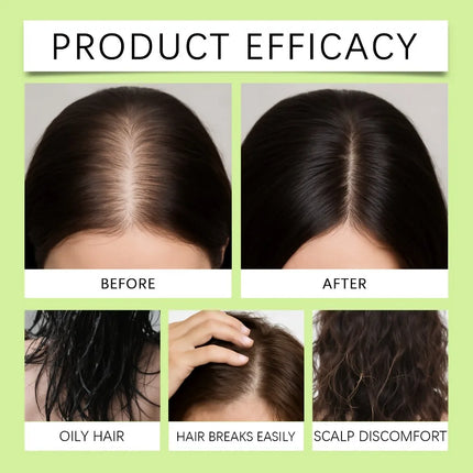 Hair Serum Gentle nourishes the scalp and cares for the softening hair care Daily Care Scalp Serum