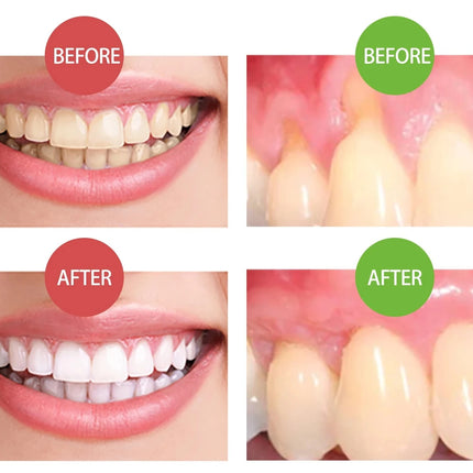 Rapid Repair Gums Gel Effectively Relieve Tooth Allergy Dental Caries Tooth Cleaning Toothpaste Relieve Tooth Damage Serum 665*