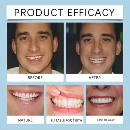 Soft Silicone Snap-On Denture Kit – Realistic Upper Lower Teeth, Instant Comfort, Strong Secure Hold, Natural Smile Replacement