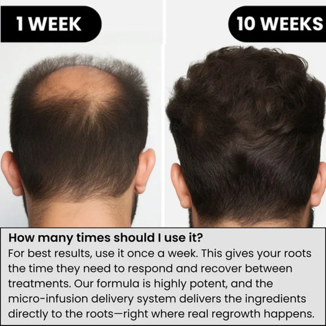 Hair Roller Serum Gentle nourishes the scalp and softens hair. Daily Care Scalp Serum