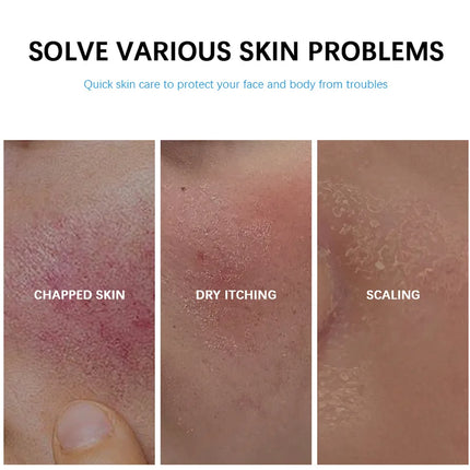 B5 Faded Facial Redness Cream Instant Spider Vein Remove Sensitive Skin Sooth Anti Redness Rosacea Treat Lotion Korean Cosmetic