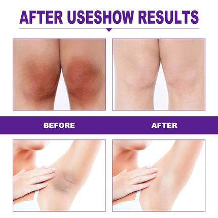 Wholesale Private Parts Lightning Cream Underarm Bleaching Serum Whiten Butt Knee Brighten Intimate Parts Dark Remove