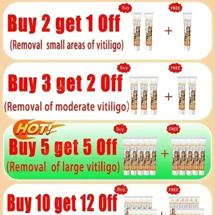 [New] Vitiligo Cream Vitiligo Remover Tinea Versicolor Body Lotion Helps Get Rid of Sweat Spot Vitiligo, Skin Vitiligo Clear