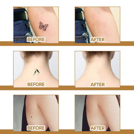 Skin concealing patch-waterproof cover for scars, tattoos, acne marks, birthmarks-natural looking, breathable, reusable