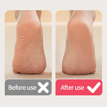 USB Electric Callus Remover Professional Rechargeable Foot File Grinder Pedicure Machine for Cracked Dead Skin And Heel Scrubbin