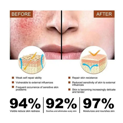 Facial Redness Repair Cream Improve Sensitive Skin Dryness Moisturizer Hydrating Sooth Lotion Removal Rosacea Korean Cosmetics