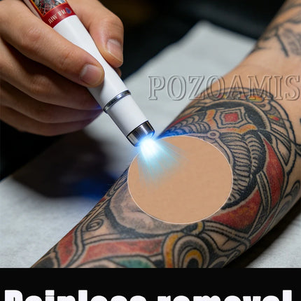 Remove old tattoos with a single click.