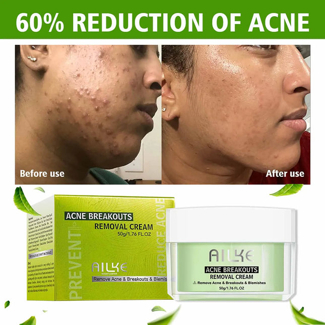 AILKE Acne Removal Face Care Set, Effectively Anti Acne-Prone Skin, Pimples, Control Breakouts, Unclog Pores, For Women and Men